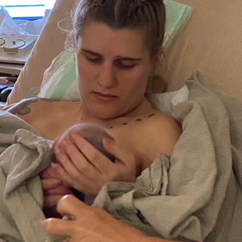 Disappearing Preeclampsia Symptoms