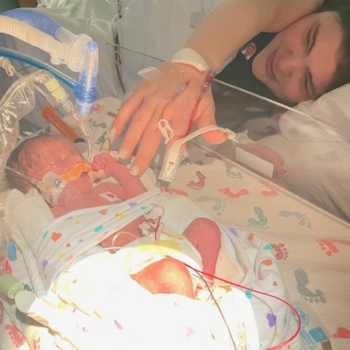 Preeclampsia Led To A Placental Abruption