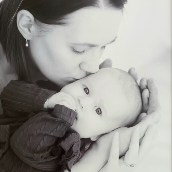 Hemorrhagic Stroke Due To Preeclampsia