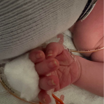 Preeclampsia Is Silent