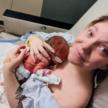 Preeclampsia