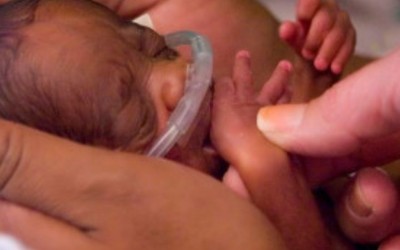 Premature Birth Creates Emotional Challenges